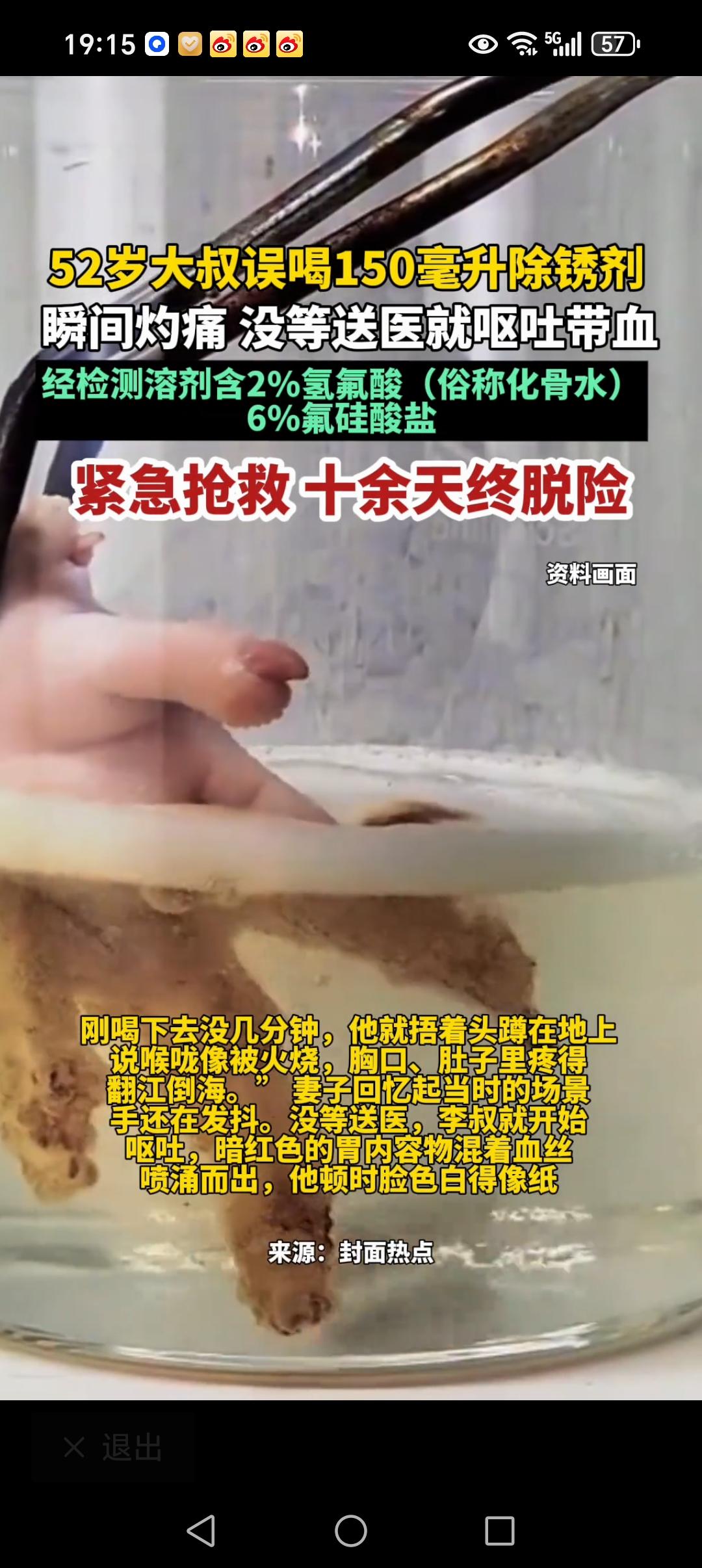 惊险一刻啊！52岁大叔误把半瓶“化骨水”当成饮料喝下肚。9月26日，52岁的