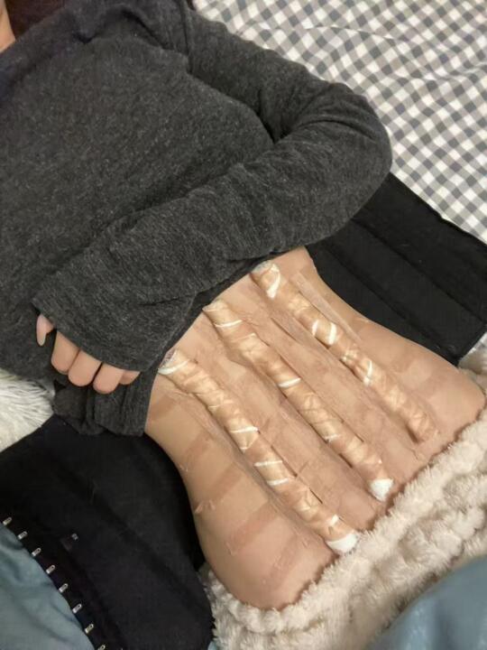 这个马甲线棉我是一天也压不下去了，真的当美女好累。压得地方都是反黑的。...