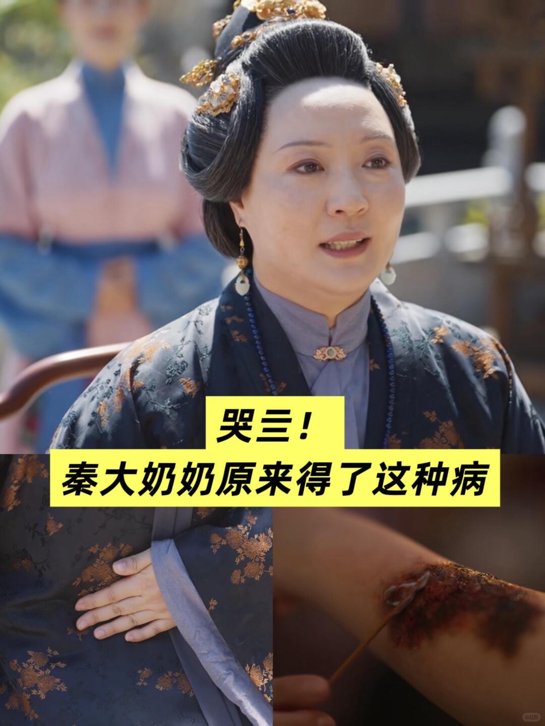 《兰香如故》里，秦大奶奶病得让我盯了好一会儿——小腹疼，晚上却让嬷嬷给发溃的