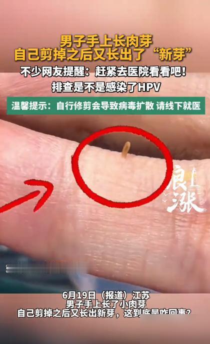 悲剧还是发生了！江苏南京这小伙也太莽撞了，手上长个不痛不痒的小疙瘩，居然直接