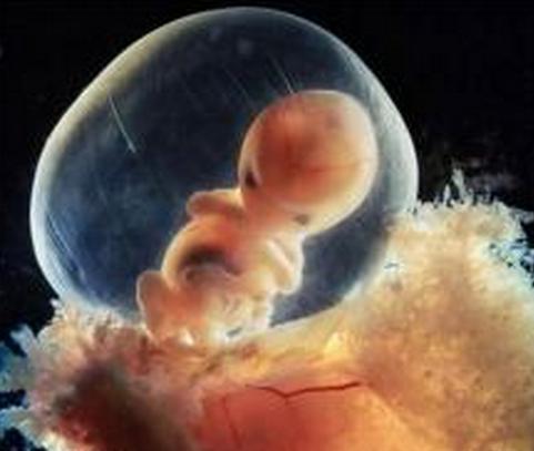让新生儿远离一辈子的缺憾, 孕妈别错过为他做这件事!