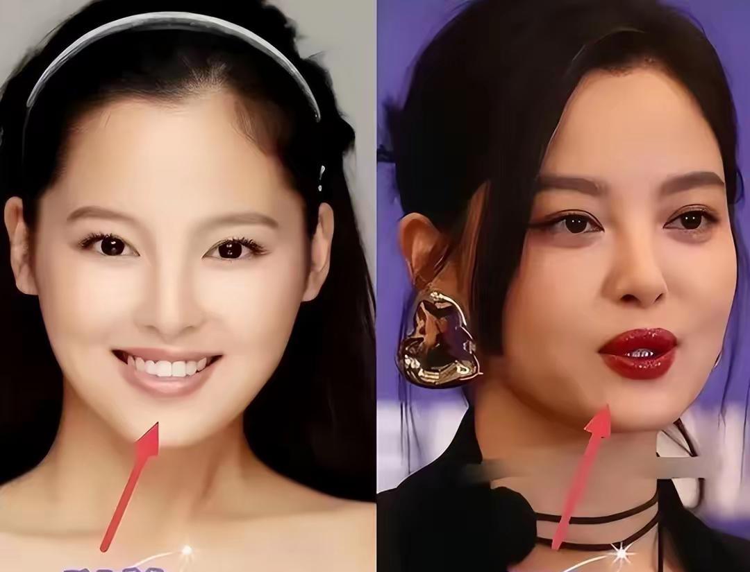 辛芷蕾背后绝对是有高人指点了吧原因是以前的她只是一个普普通通的美女，嘴唇这么