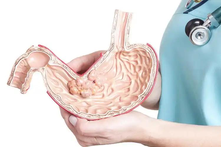 《哈佛大学分析100名胃癌患者，惊讶发现：患胃的人，有7大共性》这年头，胃病不