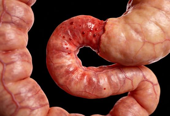 腹泻反复难止，别光吃止泻药！温补脾肾才是根，一招从源头调理  生活中你有没