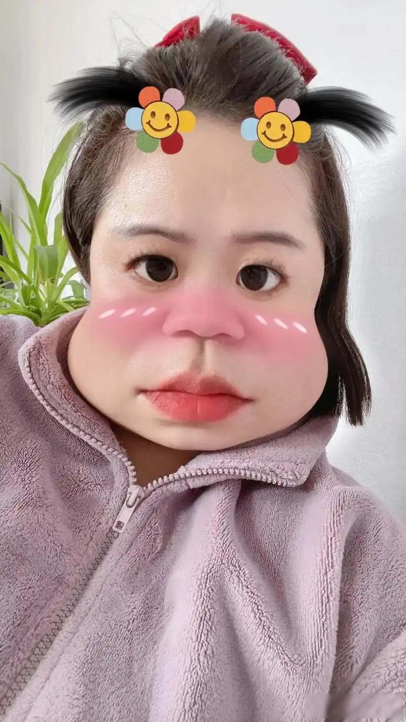 最近安徽一名24岁的女性发现自己越来越胖，从102斤涨到160斤，脸盘也越来越大