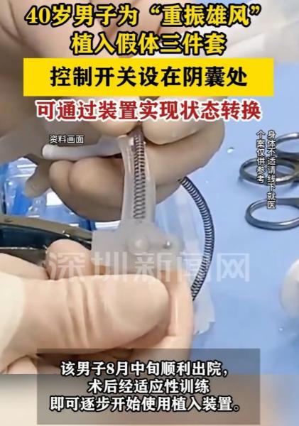 深圳，一名40岁男子看着妻子渴望的眼神，直接让医生给他植入假体三件套。9月3