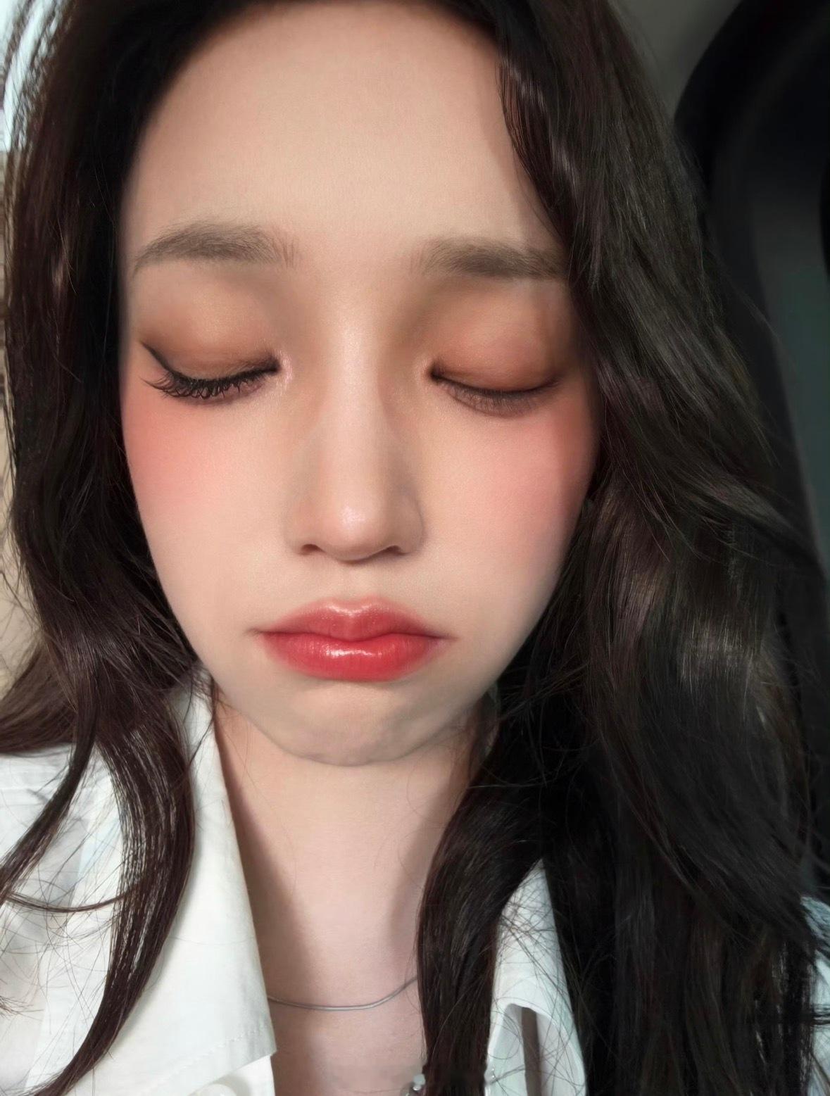 宋雨琦肿成蜜蜂小狗宋雨琦被蜜蜂蛰到脸部肿胀🥺好心疼雨琦真的太暖心了，还惦记提醒