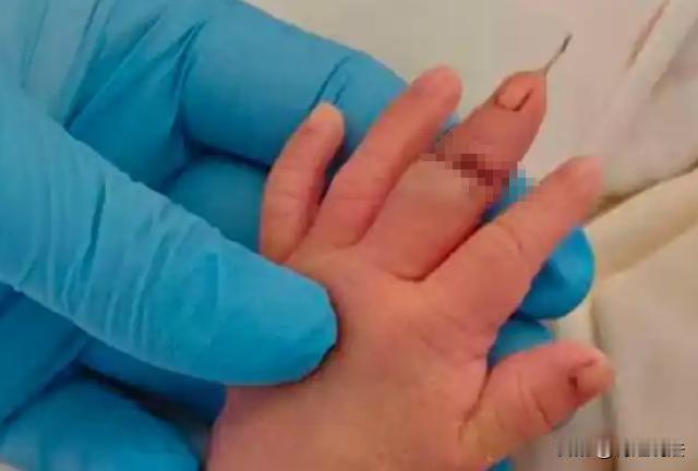 江苏，简直不敢想象，产妇怀胎十月终于临产，生下小婴儿，助产士在给孩子剪脐带的时候