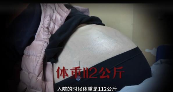 太可怕了！陕西西安，一名40岁的女子肚子疯长，一年多的时间，体重达到了112公斤