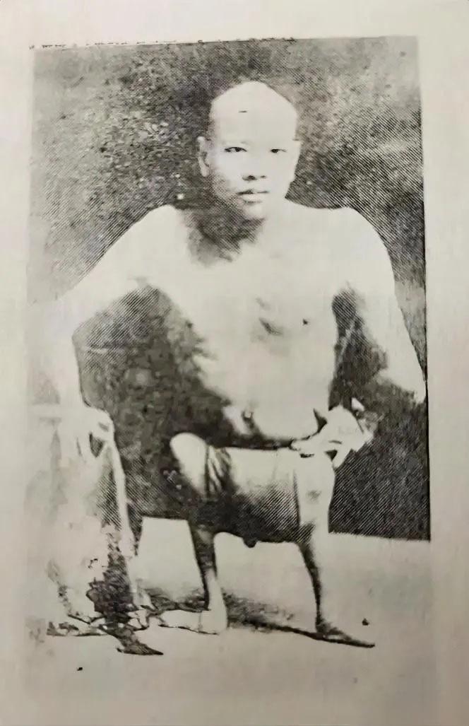 这是1920年，北平街头，一名可怜的残疾乞丐，留下了一张非常罕见的照片，最