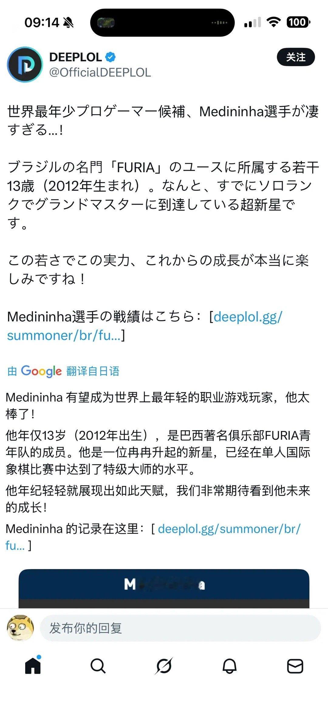 最近巴西赛区的黑豹签下了一位13岁的小朋友.虽然年龄比游戏还小但是已经是大师