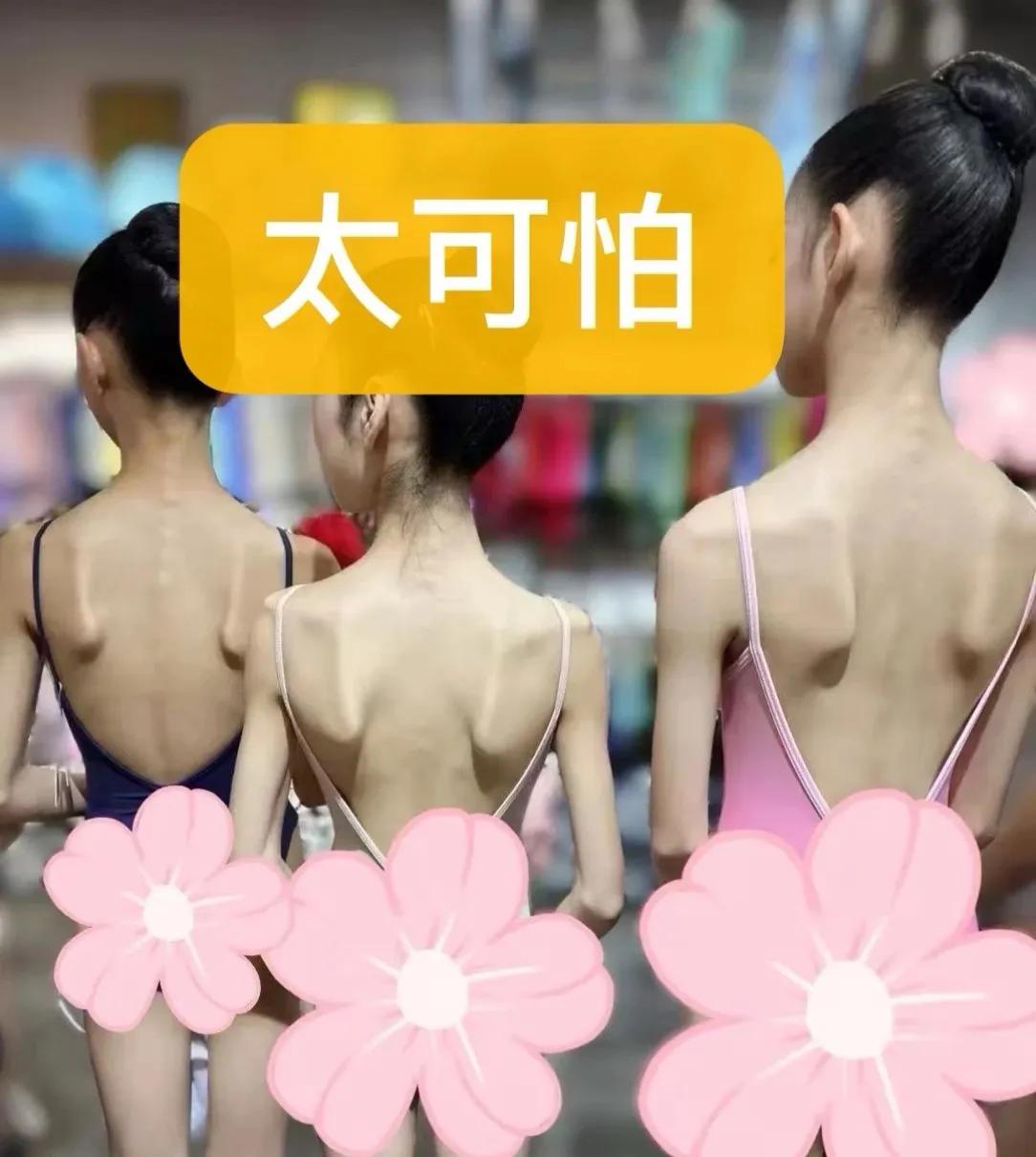 简直太可怕了，为了跳个舞有必要瘦成这样吗？！