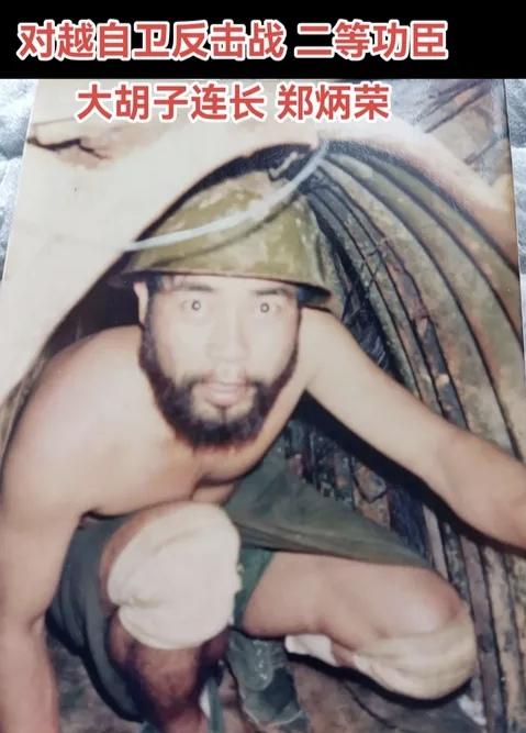 战斗英雄郑炳荣：以血肉守国门，用忠诚铸军魂郑炳荣，是对越自卫反击战，两山轮