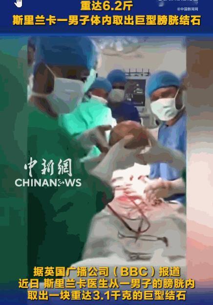 离大谱！斯里兰卡。一位55岁的患者因突发中风被紧急送医，可就在住院期间，他突