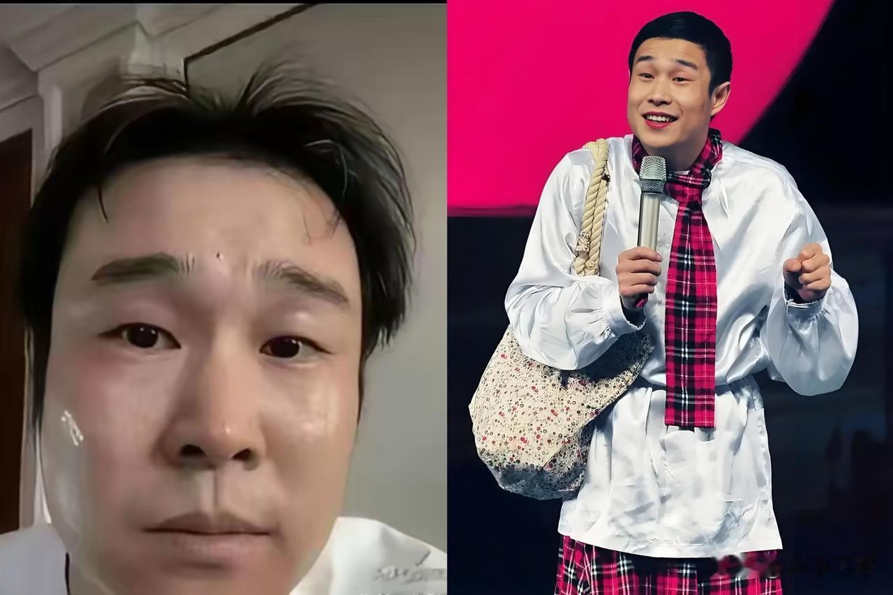 他每月给爸妈打五万块。却被网友骂不孝。小沈阳多年来雷打不动每个月给哥哥沈飞转