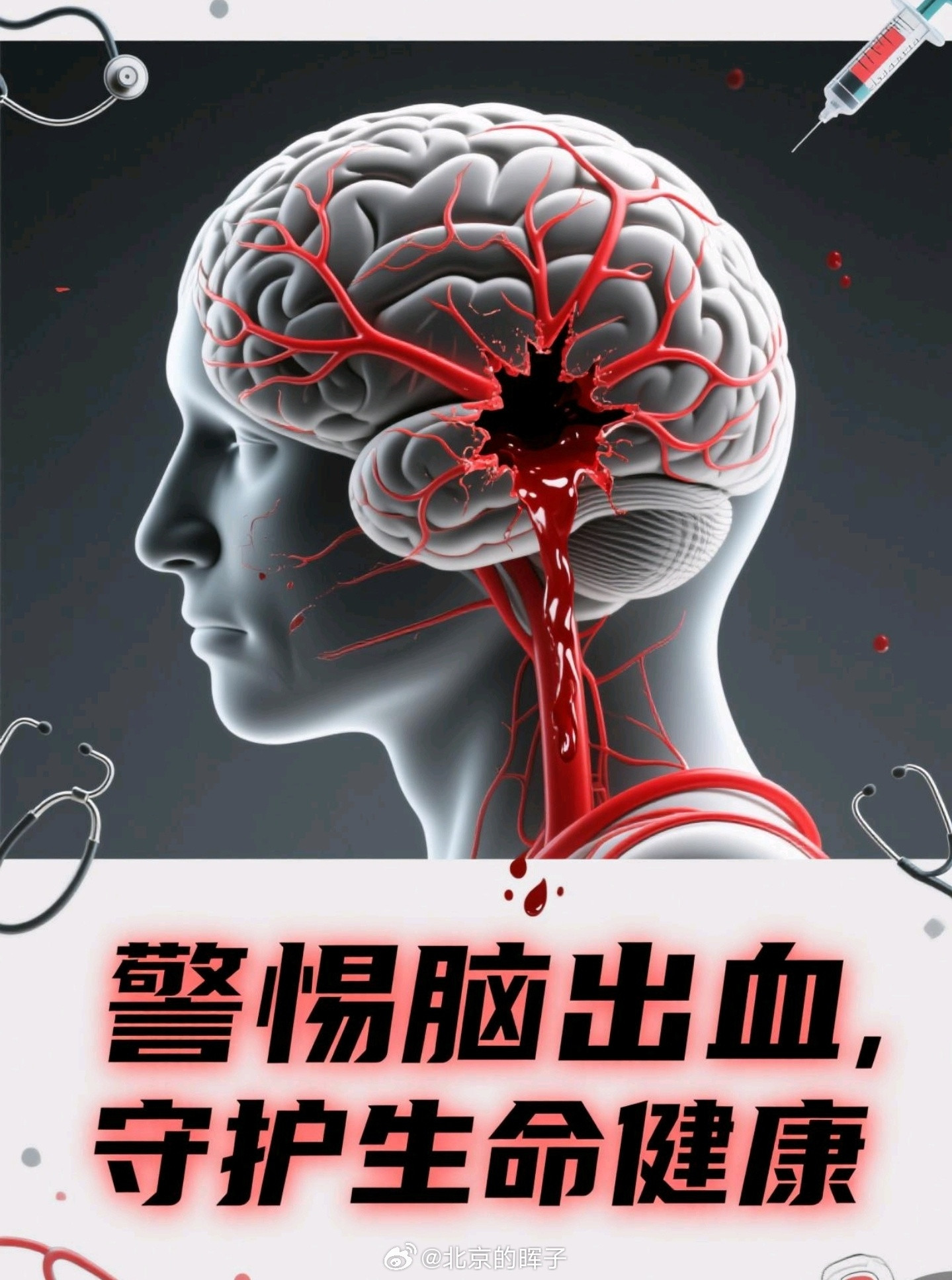 敬一丹去世人这一辈子，要好好吃饭、好好休息、好好生活，其它的交给老天爷吧急性脑出
