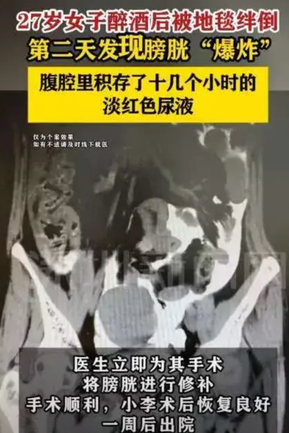 “太吓人了！”浙江一27岁女生喝醉酒断片，回到家后倒头就睡，不料，睡了十几个小时