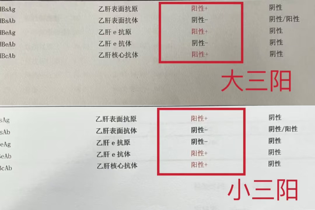 💡别再误解乙肝大小三阳！常说“大三阳害别人，小三阳害自己”其实不准确...