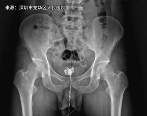 “成年人怎么能干出这种事儿？”6月23日报道，广东深圳，一位28岁的成年男子，竟