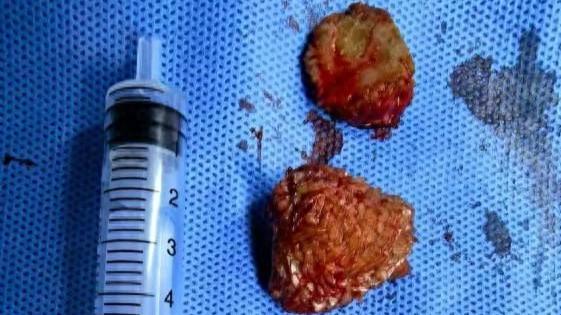 男子一天起码换三次内裤! 医生: 20多年都很少碰到, 这个习惯可能你也有