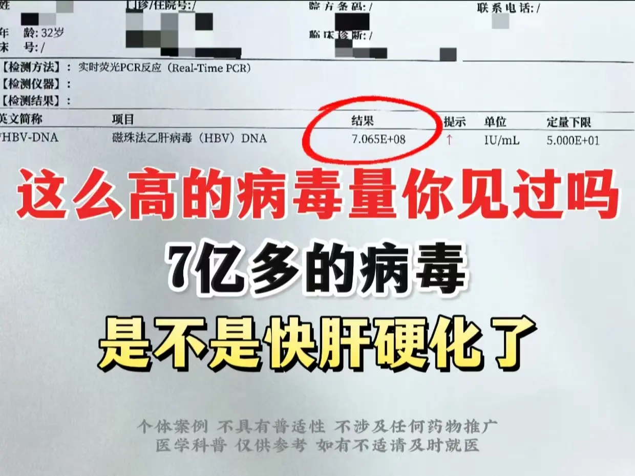 刚刚32岁的一个小伙子，查出来一看病毒量8次方，瞬间就慌了，跟我说...