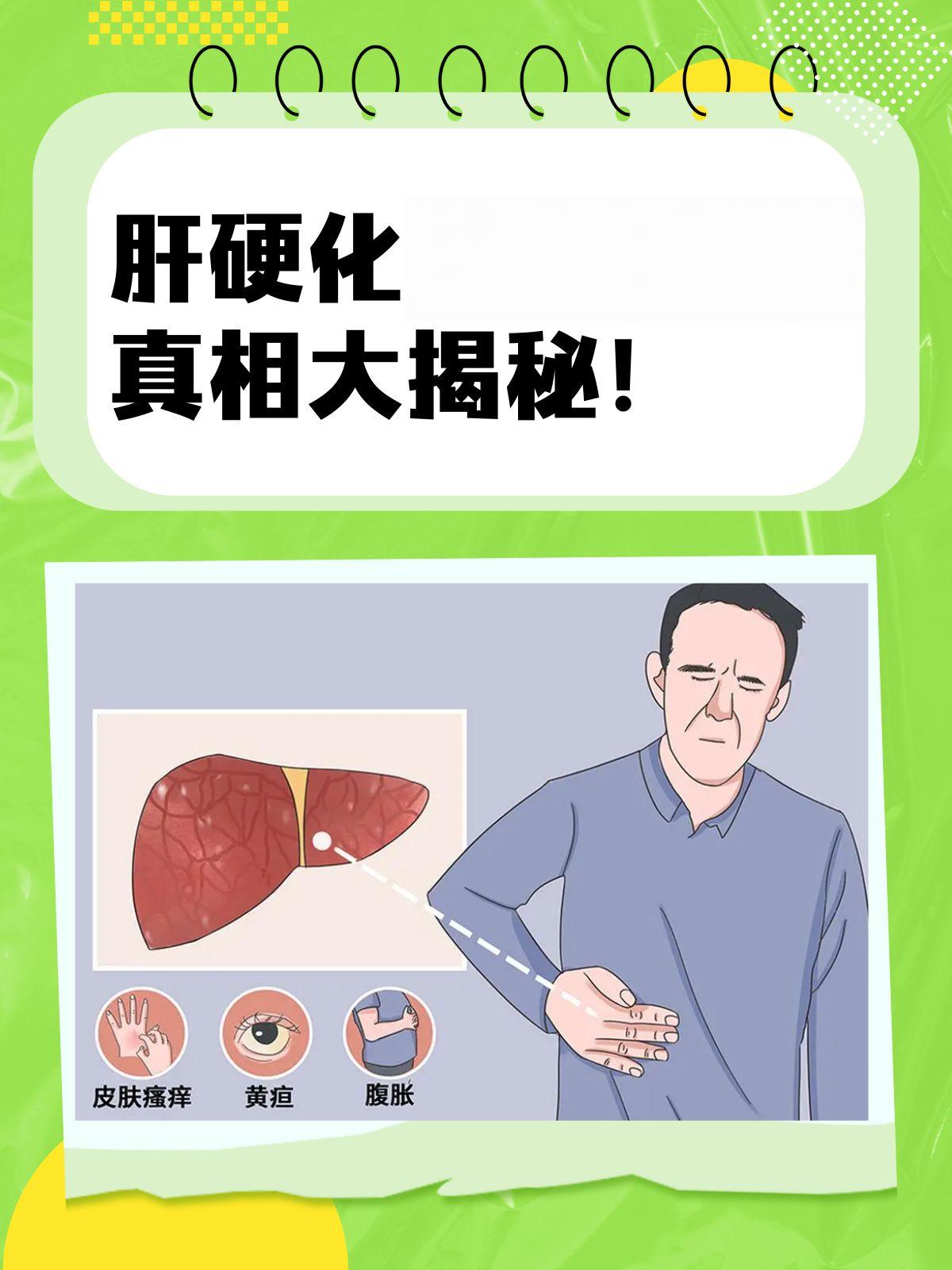 肝硬化的真相，希望每位患者都知道！别以为肝硬化是突然找上门的，它其实是肝