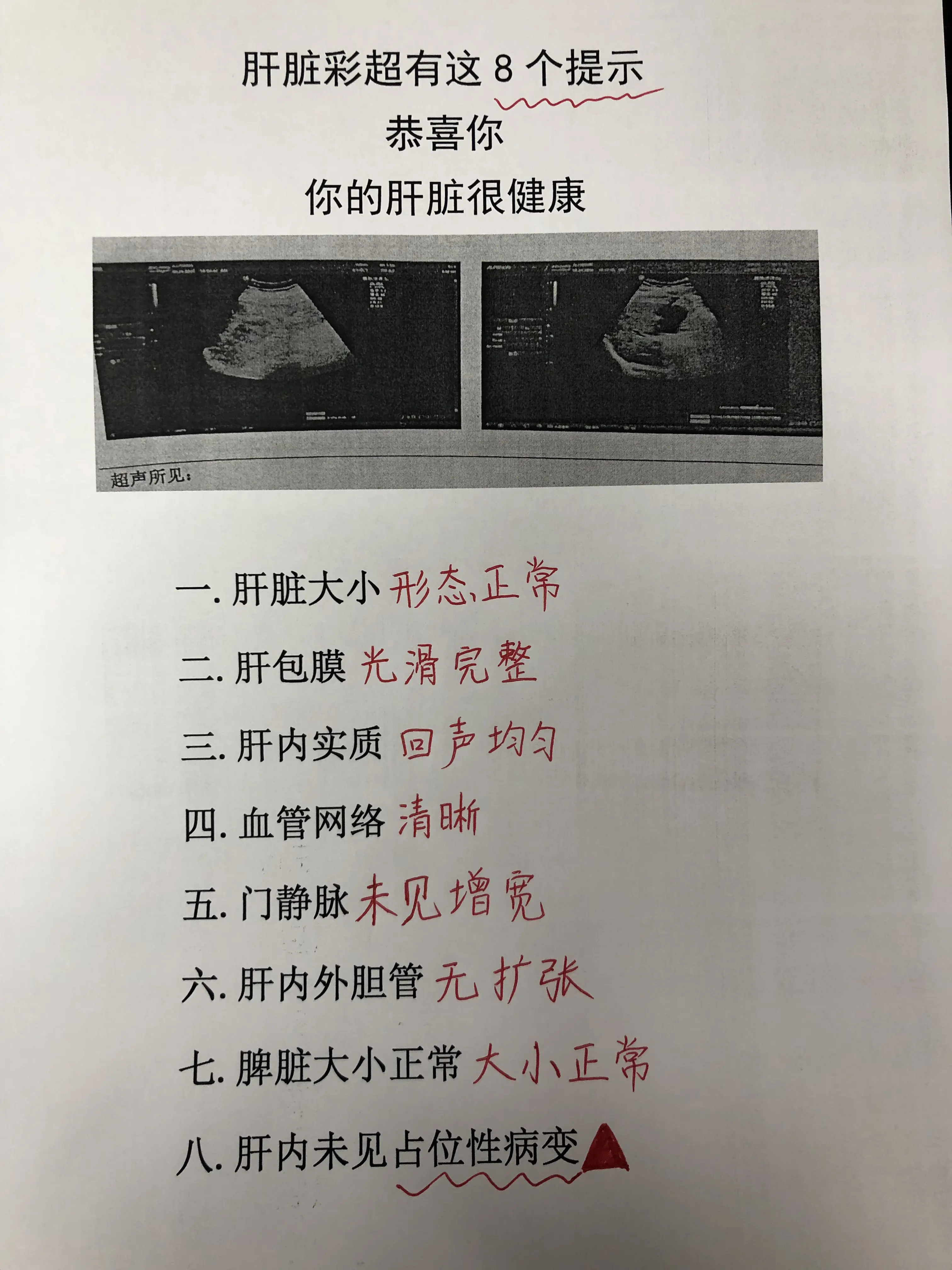 乙肝 肝硬化 肝脏彩超 脾脏 肝病教授陈士俊