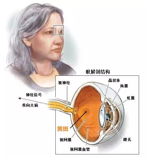 眼科门诊中,很多人会指着自己的眼睛问医生:我眼睛上长了黄斑,是得了