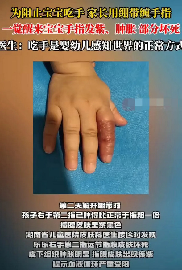没文化，真可怕！湖南这一对年轻的父母，为了让11个月的孩子不要吃手，直接网购