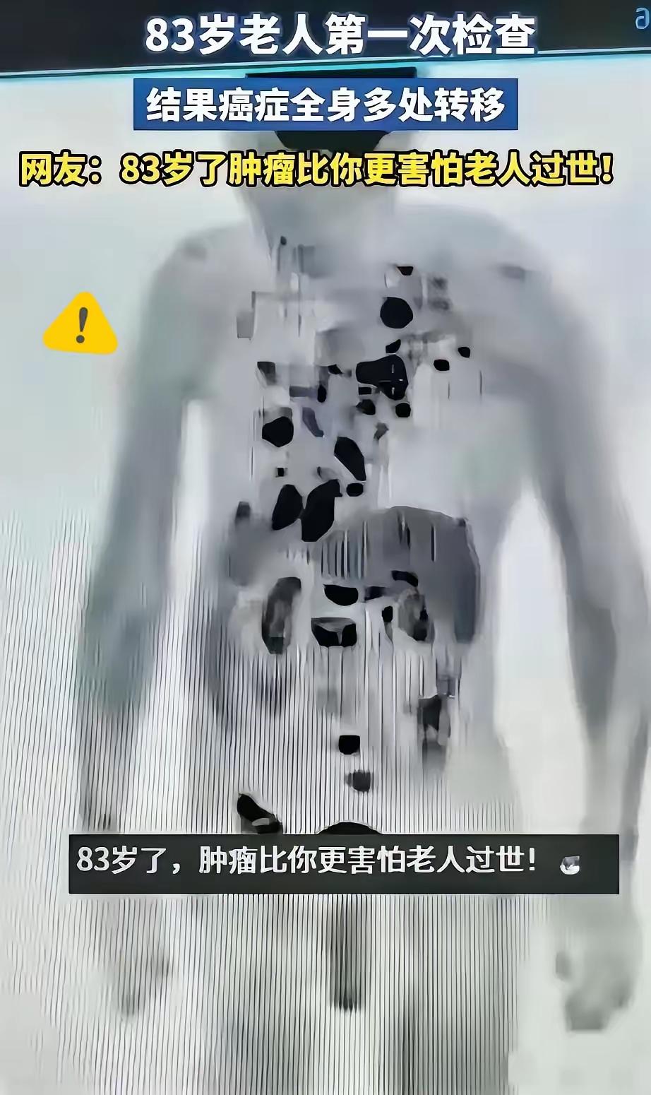 真的别再用“为你好”瞎折腾老人了！83岁大爷身体硬朗、精神头十足，儿女非要尽