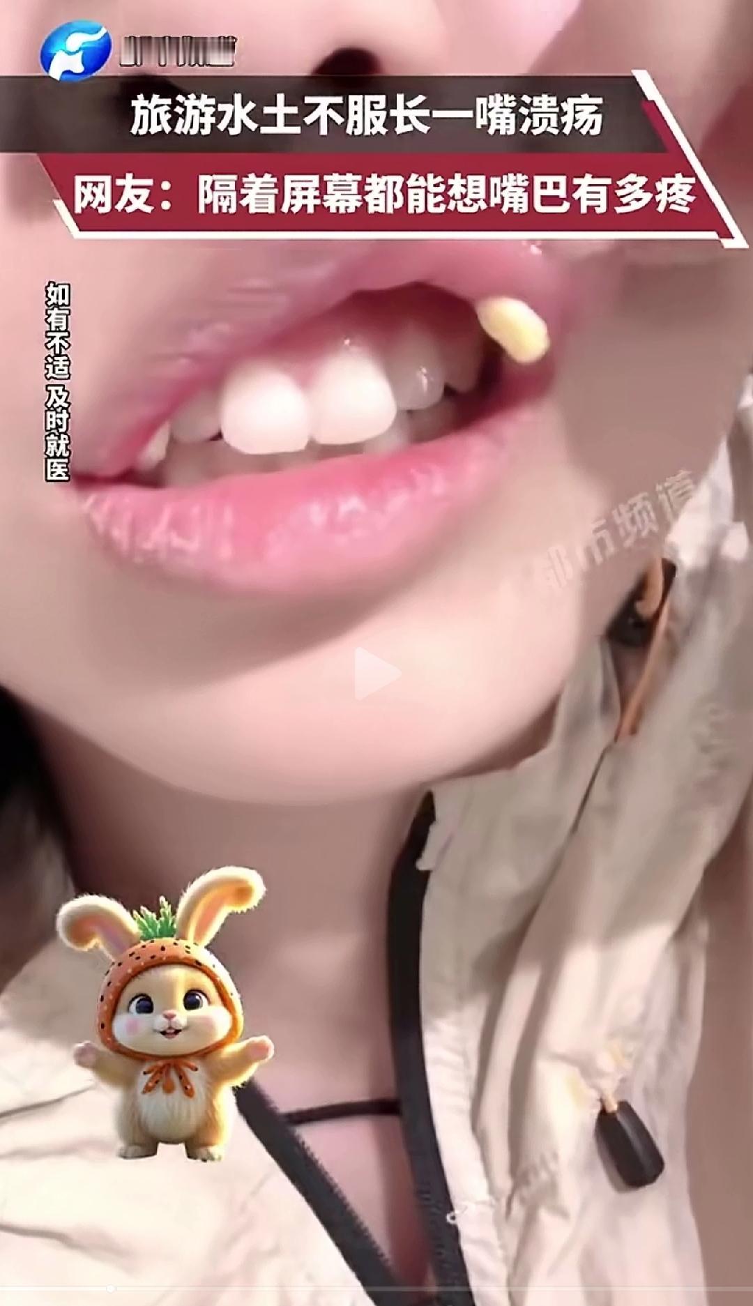 这绝对不是口腔溃疡，还是上医院检查一下病毒吧，口腔溃疡不是这样凸起的形状的。