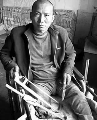 2012年4月，河北一男子为省百万住院费，亲手锯掉右腿，历时20分钟，期间为忍7