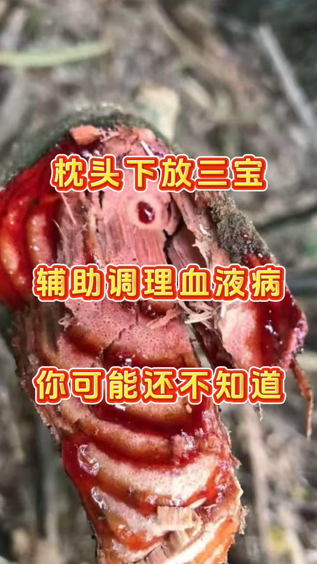 大家好，我是张广蕊医生。每天花1分钟，带您了解实用的血液病调理小知识。血液病种类