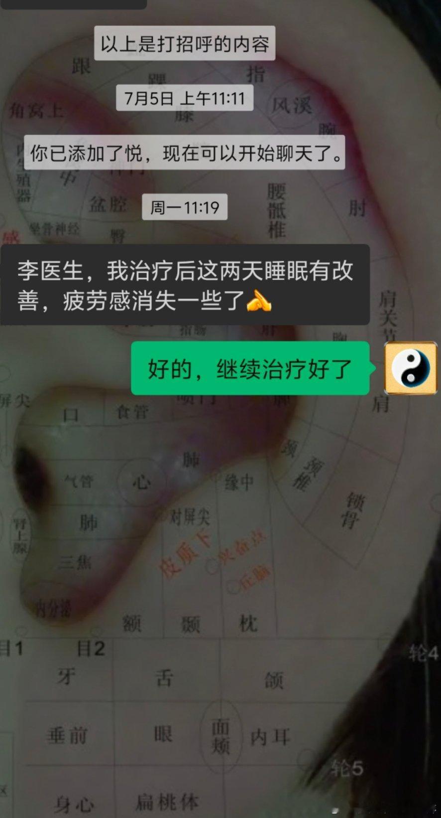 有些焦虑症失眠，伴有疲劳。但是摸脉象不是很虚，是一种弦绷得很紧的一种感觉。说明人