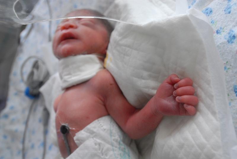 浙江宁波这起5月龄早产女婴心脏手术离世事件，看得人心里五味杂陈。宝宝本就提前一个