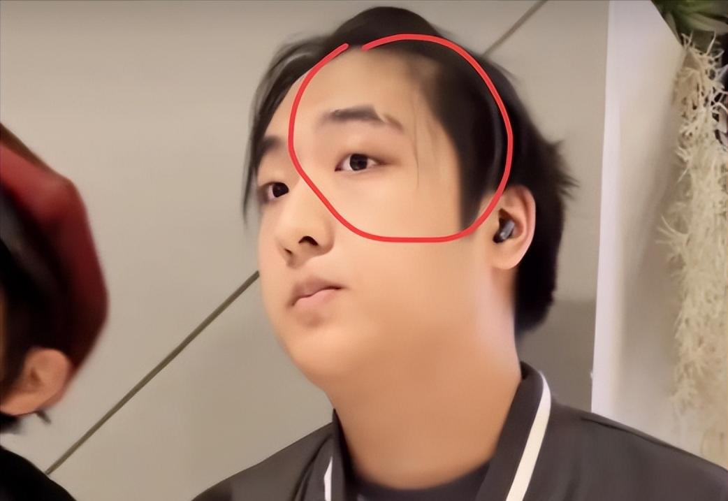 看到费曼脸上那道触目惊心的伤痕，我才明白当初吴镇宇怒掷麦克风的举动并非过激。