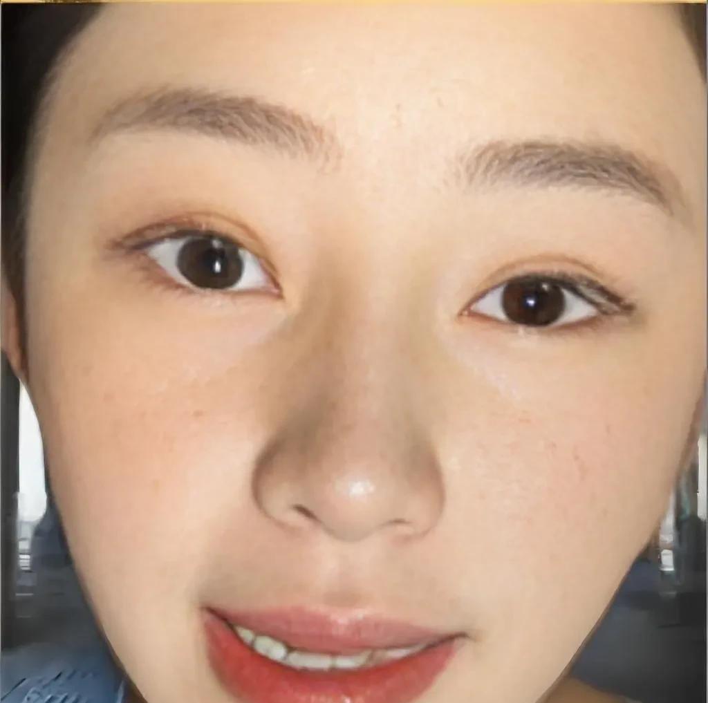 整容真是一条不归路，黄一鸣现在的鼻子是经过修复的。黄一鸣的眼睛、鼻子都是花钱整