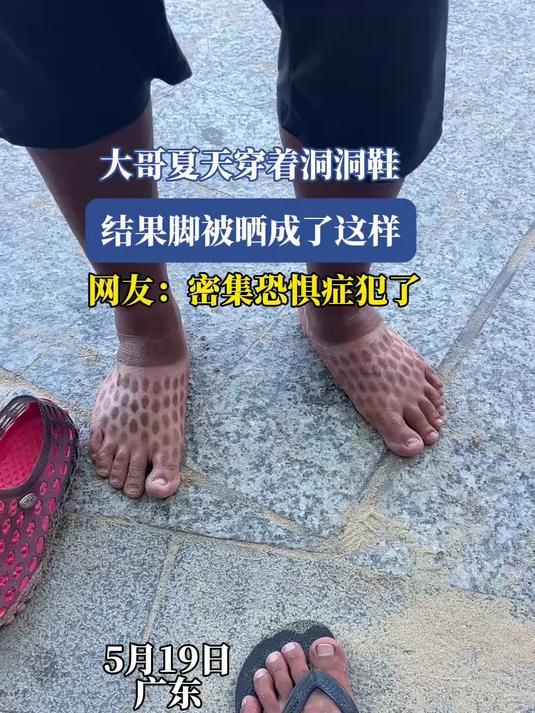 洞洞鞋突然卖不动了洞洞鞋巨头股价暴跌30%材质不咋地，而且还容易打滑突然