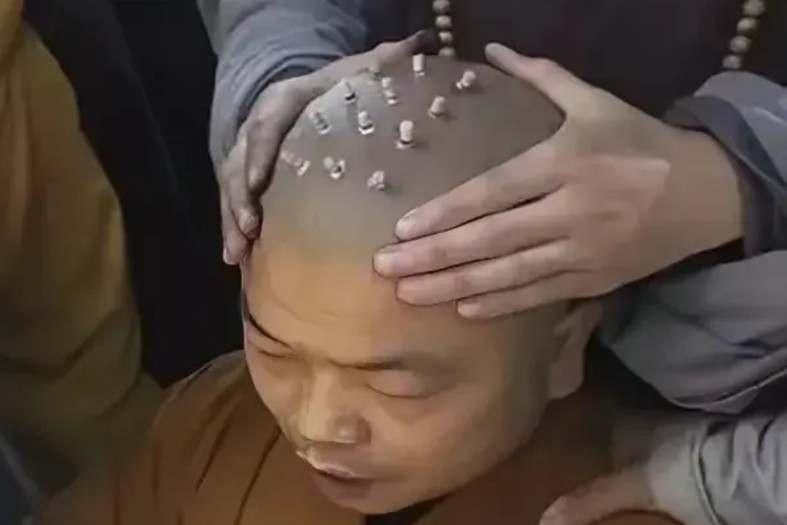 有很多网友说和尚要恢复烫戒疤，能接受这种痛苦的人才是真心想入佛门的人，不然进去了