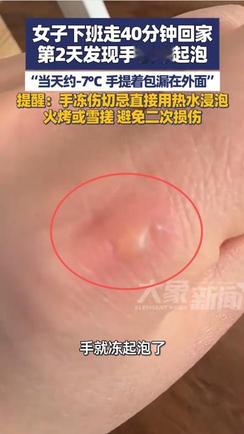 “悲剧还是发生了！”近日，河南洛阳，一女子下班后发现下雪了，于是便决定步行40分