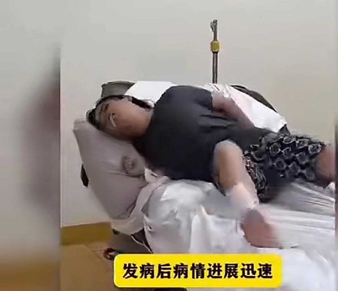 狂犬病也太吓人了，还好，养狗的人，大概率。