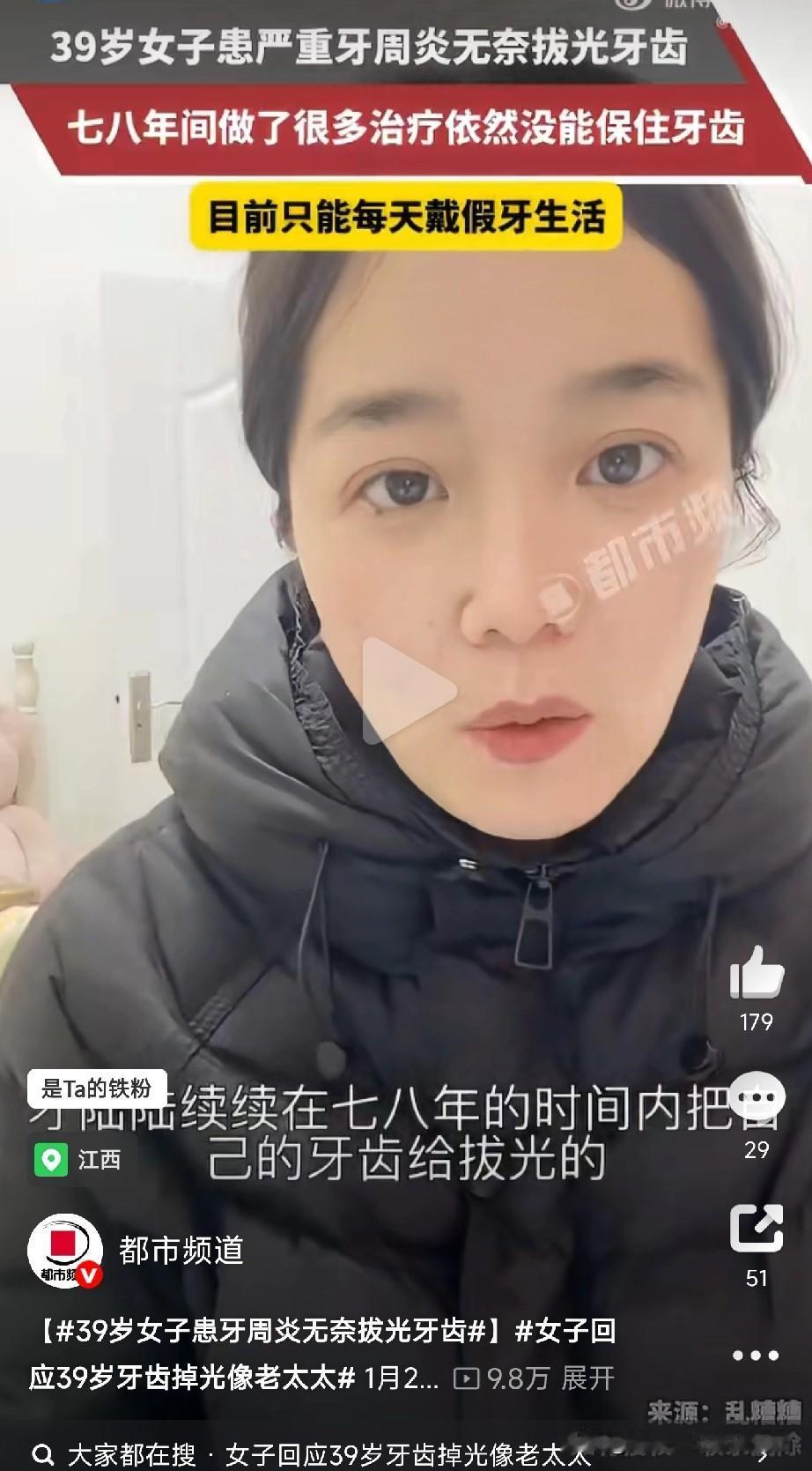 一定要注意保护牙齿江西一位39岁的女士，七八年来反复治疗严重的牙周炎，最终还