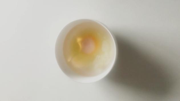 牙龈肿痛吃什么药