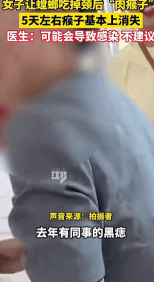 这绝对是狠人！山西，女子相信偏方让螳螂吃掉自己颈部后边长得肉瘊子，只是感觉螳螂啃