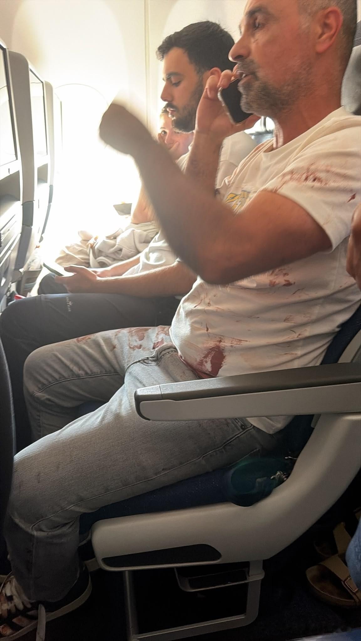 以色列媒体报道说，在迪拜航空客机飞行员打斗事件中，正义的机长战胜了邪恶的副驾驶。