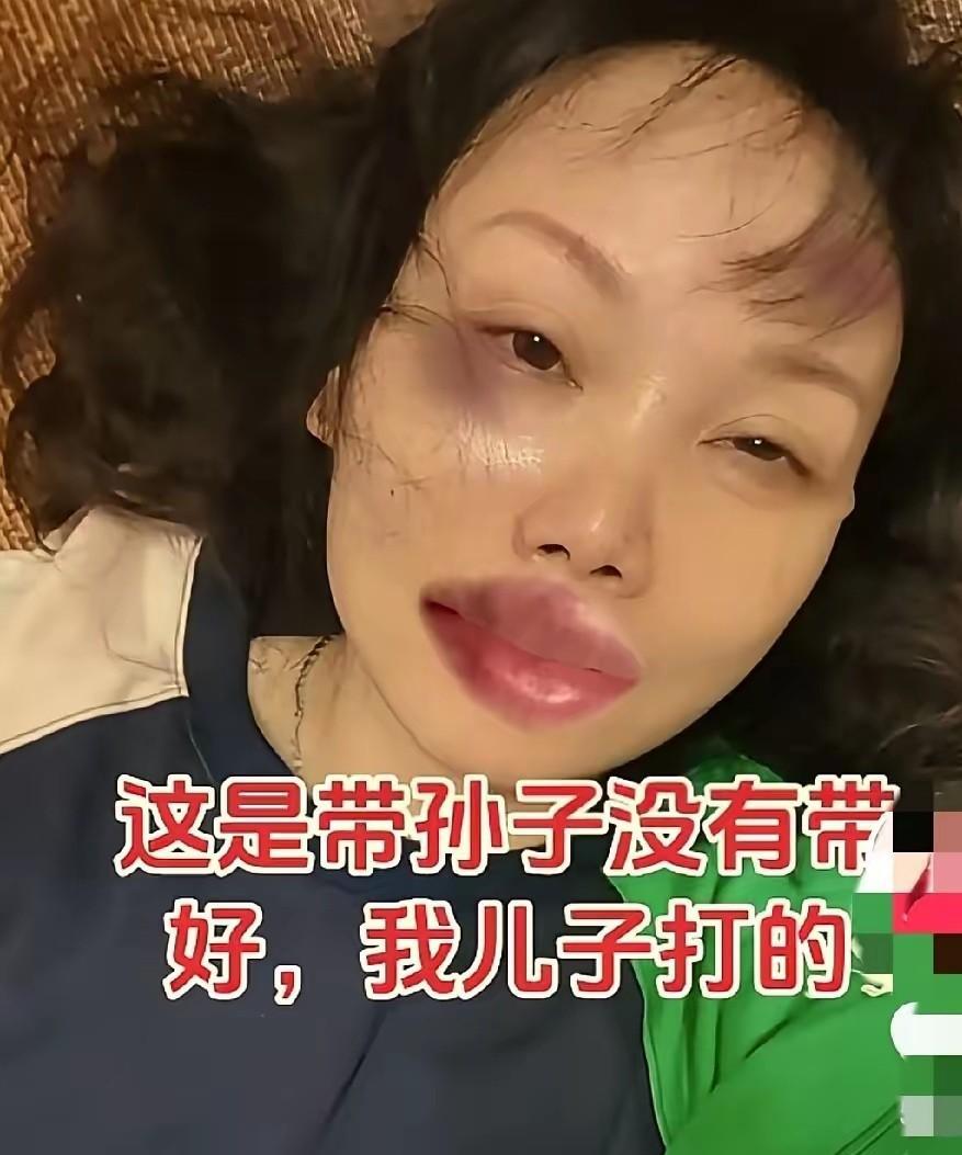 感觉这不是被儿子打的，而是被化妆品打的。这世上有这种儿子吗？亲妈没带好孙子就