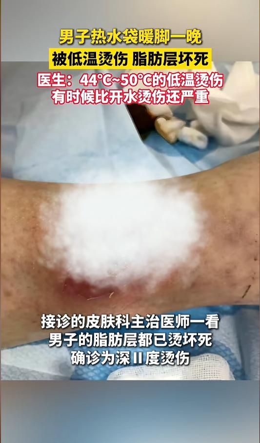 “悲剧还是发生了！”近日，福建福州，一50多岁男子睡觉时将暖水袋放在脚边取暖，一