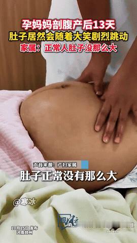 河南一女子生完小孩后，肚子却并没有变小，反而有变大的趋势，甚至比生孩子前还要大，