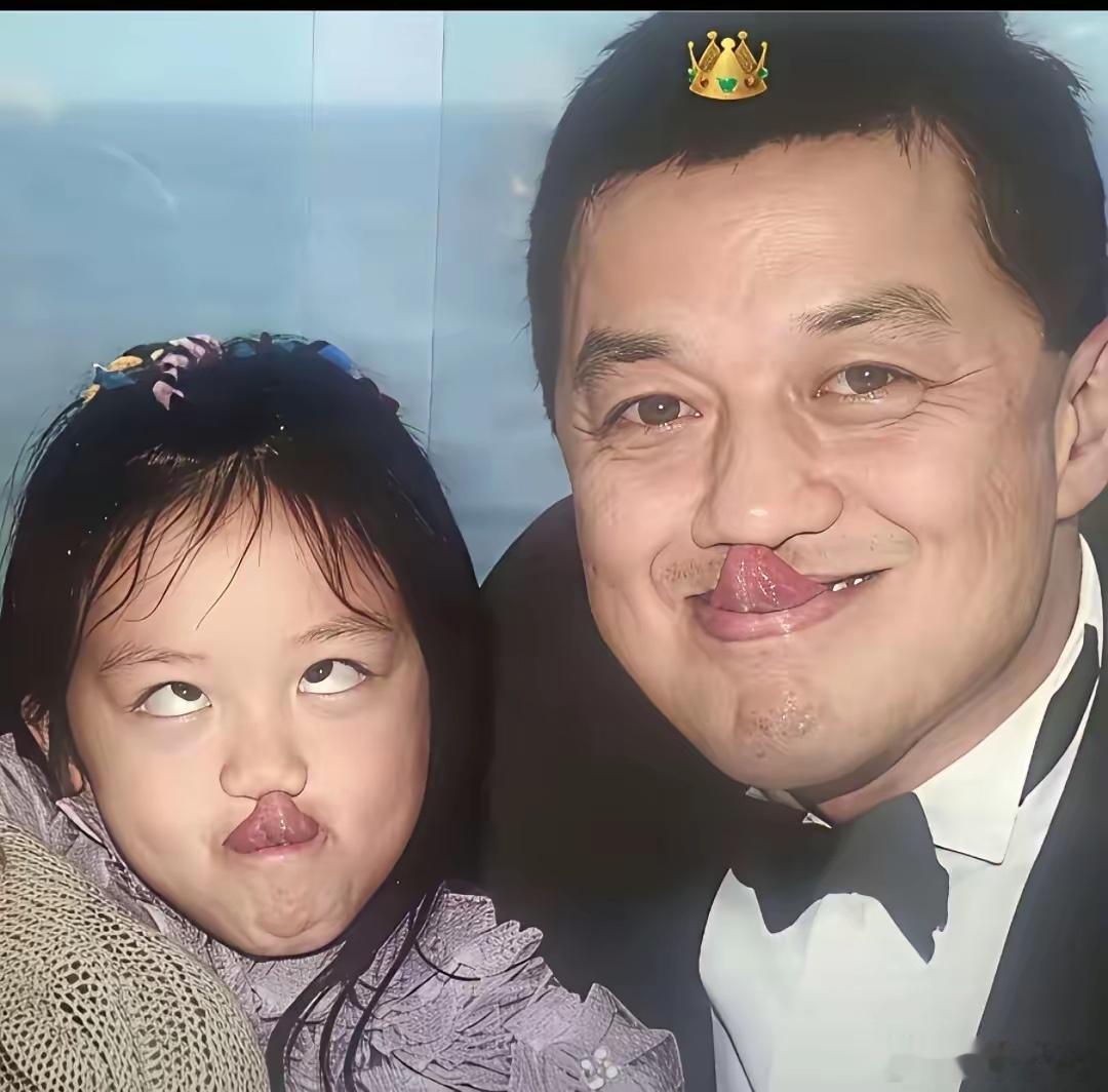 李亚鹏说，当年王菲怀孕5个月时，就已查出肚中胎儿患有先天性唇裂。夫妻俩人都不忍心