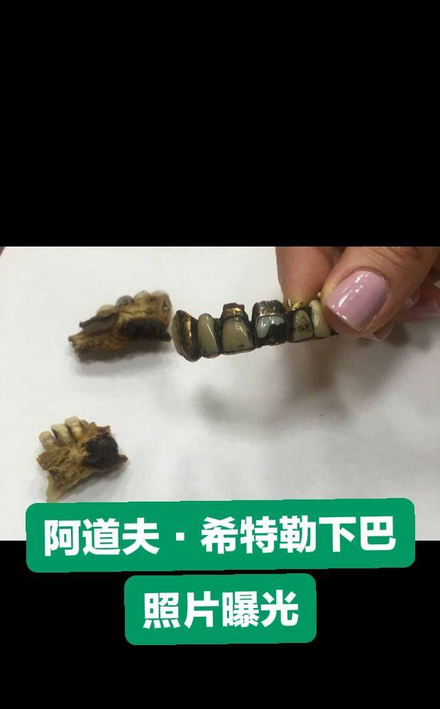 原来，它被存放在联邦安全局档案馆的一个小烟盒里。其中最大的一块碎片是上颌骨的骨桥